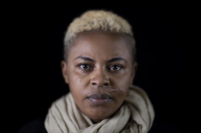 Azata Soro, actrice et réalisatrice burkinabè : « Je me surprends à me regarder dans le miroir et à oublier la cicatrice » 2 Azata Soro, actrice et réalisatrice burkinabè : « Je me surprends à me regarder dans le miroir et à oublier la cicatrice » 2