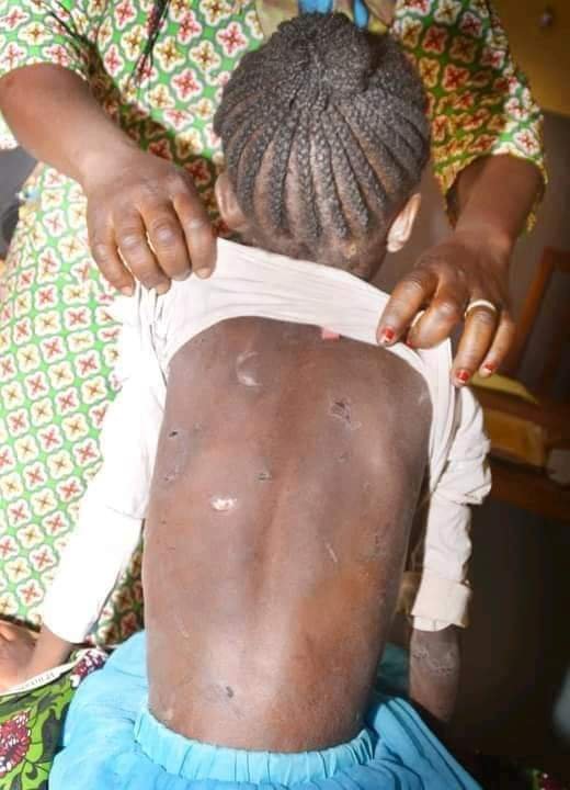 Ouagadougou : une enfant de 08 ans victime de violence physique sauvée par la police municipale 11