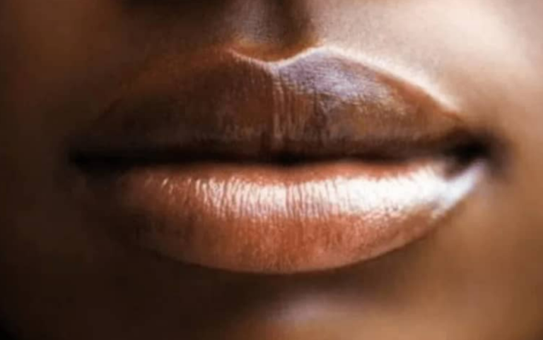 Lèvres sèches en période d'harmattan : quelques astuces naturelles pour y remédier 1