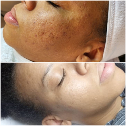 Santé de la peau : quand quatre jeunes femmes passionnées du médico-esthétique ouvrent Black Pearl à Ouaga 3