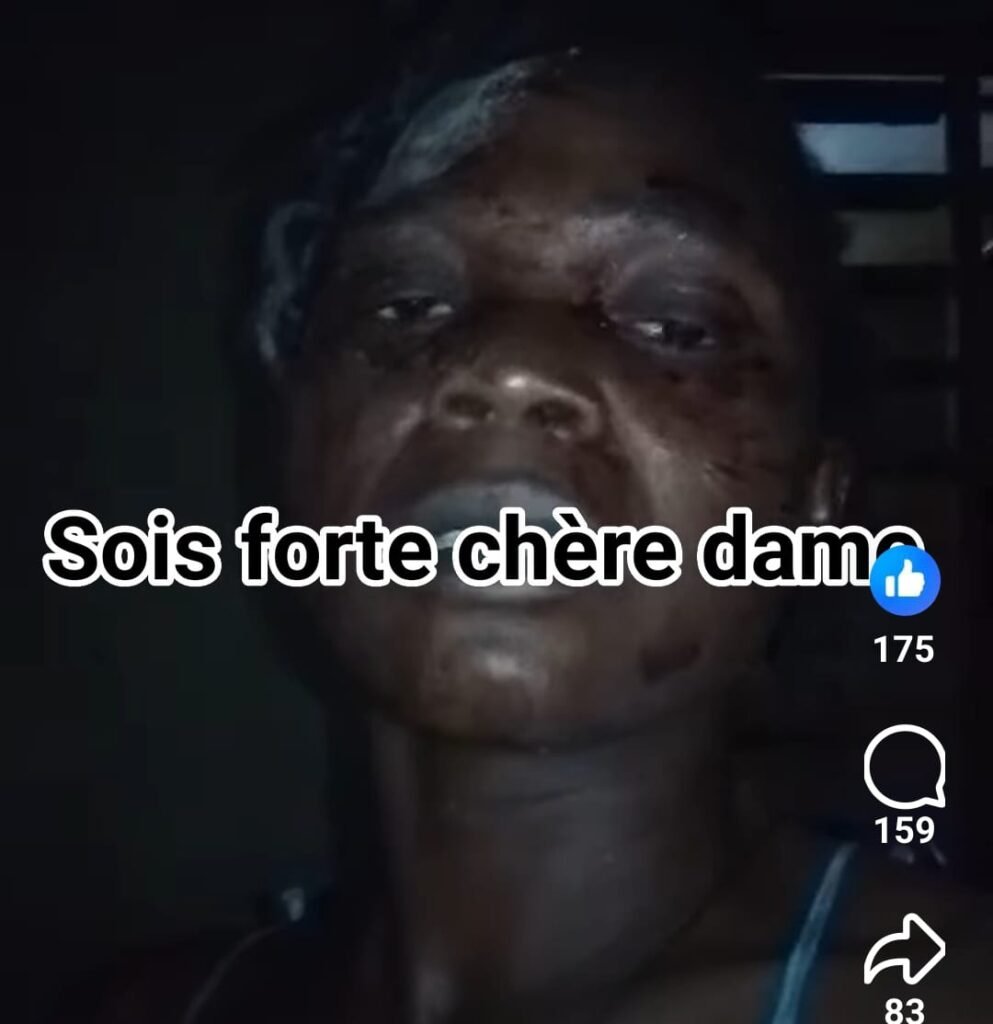 Drame : Une femme agressée par son voisin après avoir refusé ses avances 2 Drame : Une femme agressée par son voisin après avoir refusé ses avances 2