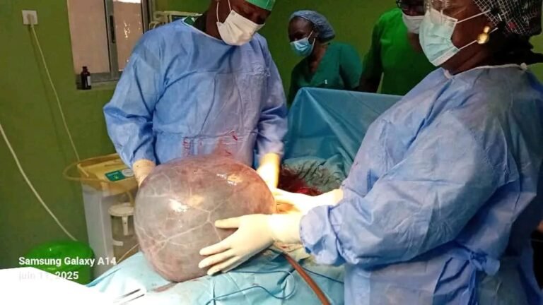 Tenkodogo : Une femme soulagée d’un kyste ovarien de 20 kg 1 Tenkodogo : Une femme soulagée d’un kyste ovarien de 20 kg 1