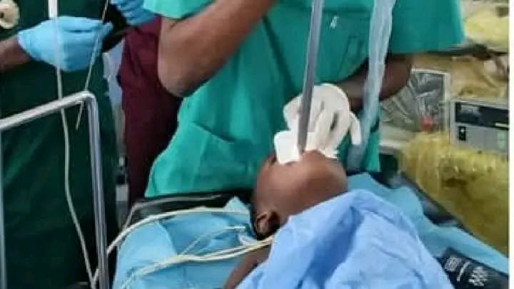 Dédougou : Une pièce de 500 F retirée en une minute de l’œsophage d’un enfant 2 Dédougou : Une pièce de 500 F retirée en une minute de l’œsophage d’un enfant 2