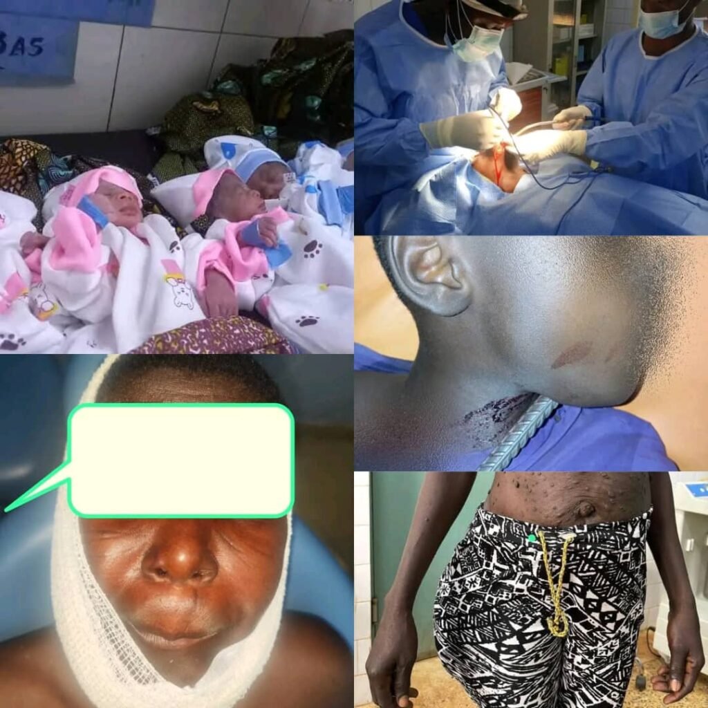 Burkina Faso : Les « VDP de la santé » au front pour sauver des vies 3 Burkina Faso : Les « VDP de la santé » au front pour sauver des vies 3