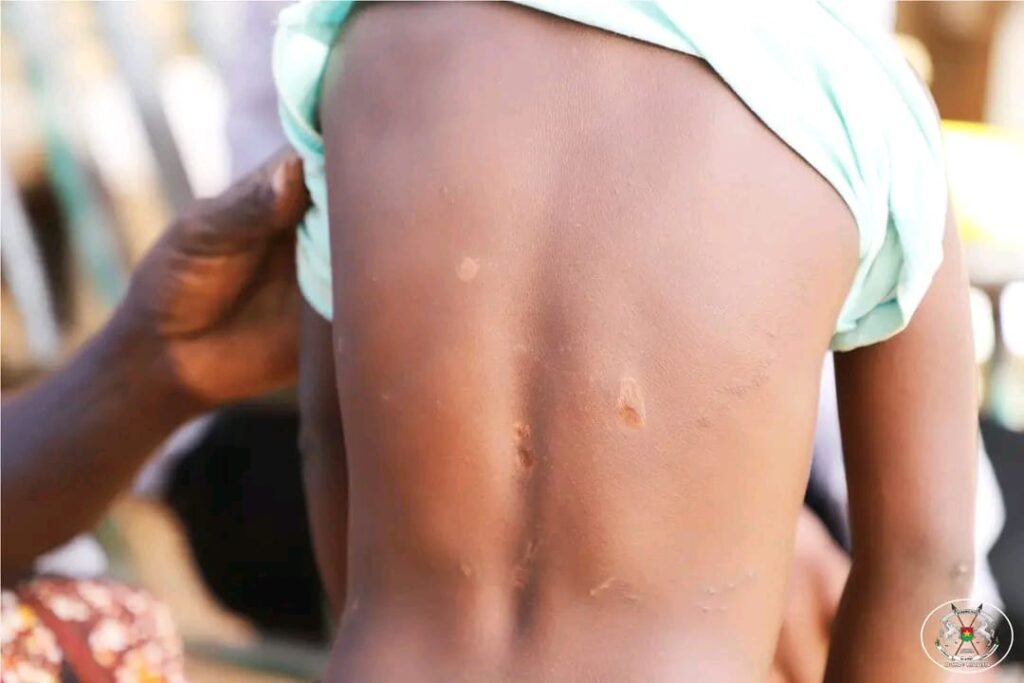 Koudougou : Le calvaire d’Innocente, 3 ans, victime de violences familiales 2 Koudougou : Le calvaire d’Innocente, 3 ans, victime de violences familiales 2