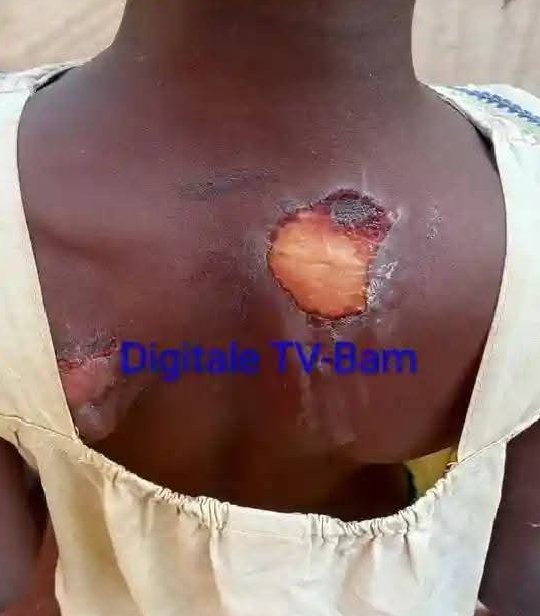 Kongoussi : Une enseignante à la barre pour maltraitance sur sa nièce 2