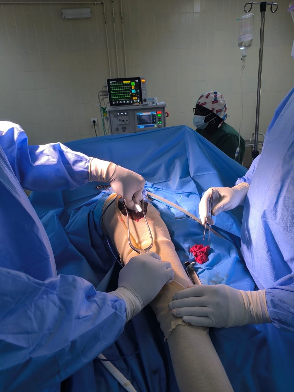 Santé : Une patiente de 65 ans bénéficie d’une prothèse intermédiaire totalisable de la hanche droite